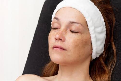 safest treatment for pigmentation on the face